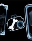 x-ray photo
